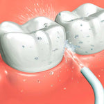 IRRIGADOR BUCAL ORAL 4 CABEZAS
