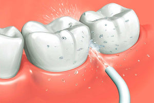 IRRIGADOR BUCAL ORAL 4 CABEZAS