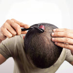 DERMA ROLLER