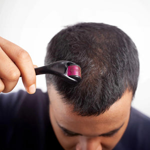 DERMA ROLLER